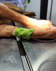 VENDAS ELASTICADAS