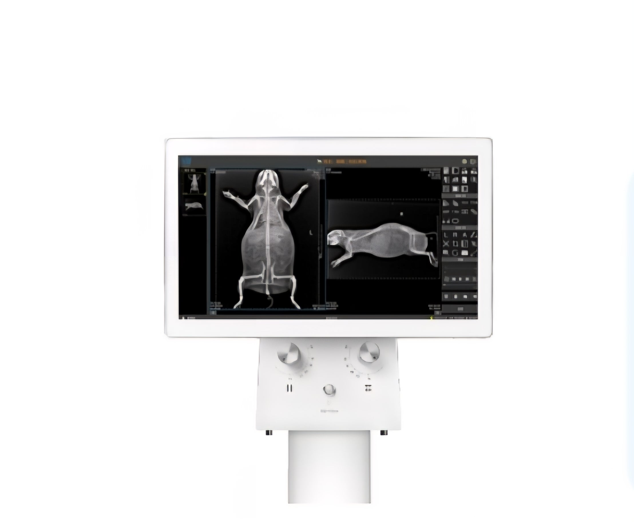 SISTEMA RADIOLOGICO DIGITAL DIRECTO DX-VF1